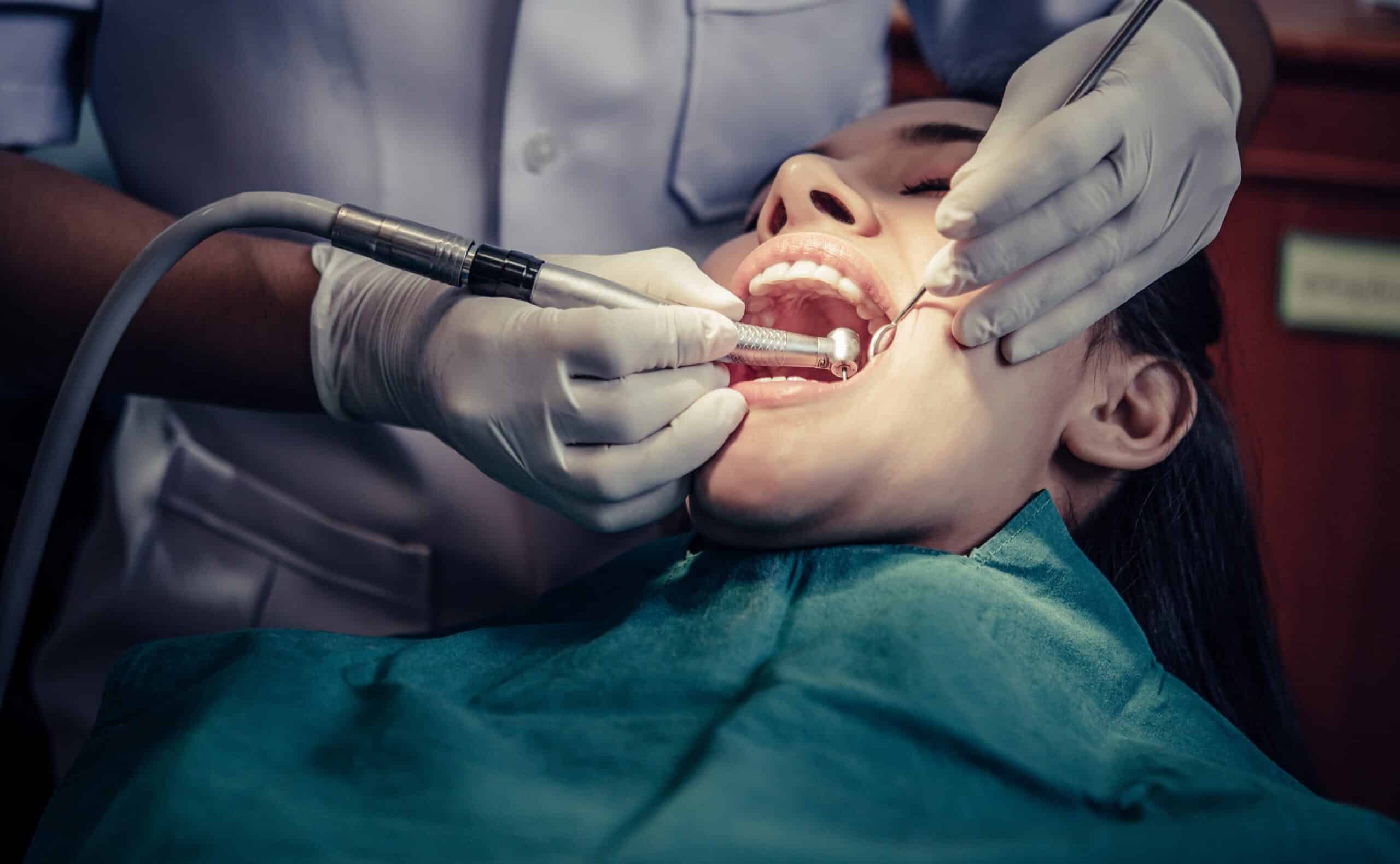 Cirugía Dental